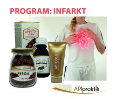 PROGRAM: INFARKT